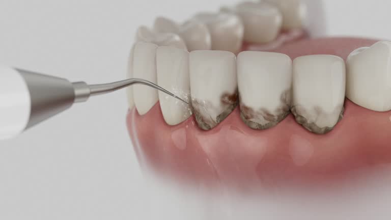 Reliable Teeth Cleaning And Checkup contractor in Montgomery County County, OH by Dentist Open Now